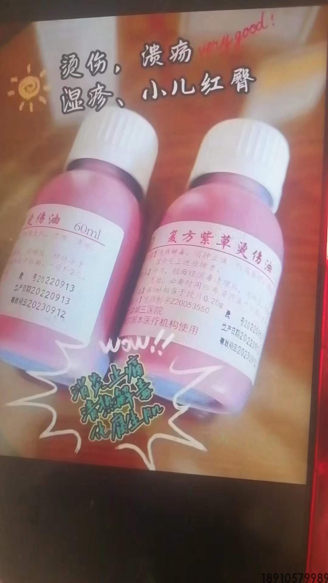 复方紫草烫伤油